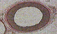 Cross section of a normal artery