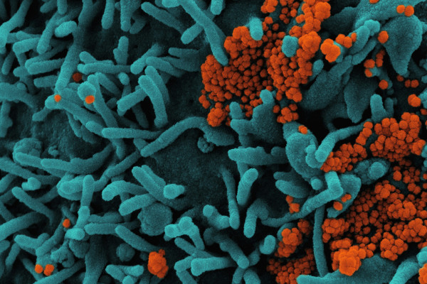 Disease cells