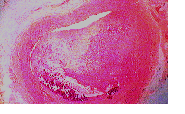 Cross section of an artery with