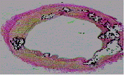 Cross section of an artery with