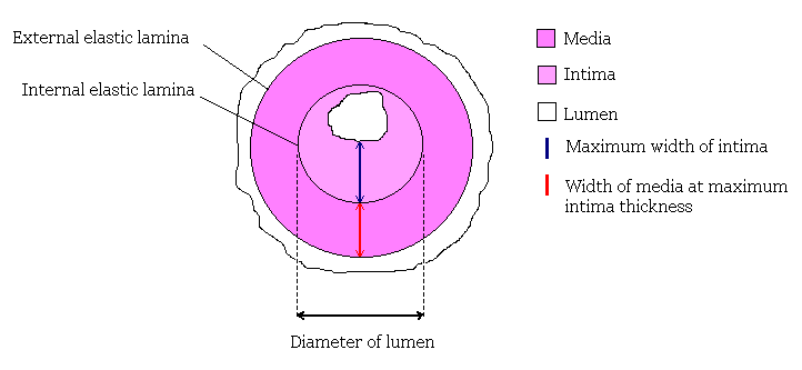 Diagram of cross section of artery